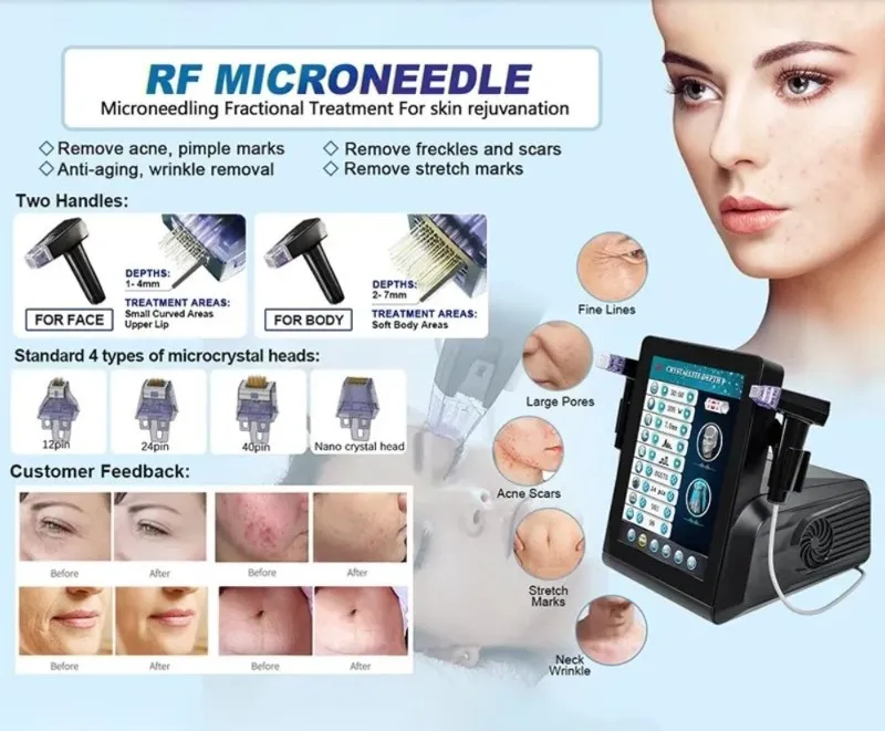 Fractional RF Microneedling Morpheus 8 Machine 6 Fractional RF Microneedling Morpheus 8 Machine 6