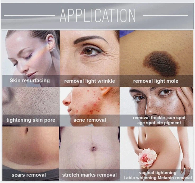 Co2 Laser Skin Resurfacing Machine 2 Co2 Laser Skin Resurfacing Machine 2